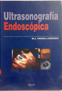 Ultrasonografia endoscopica